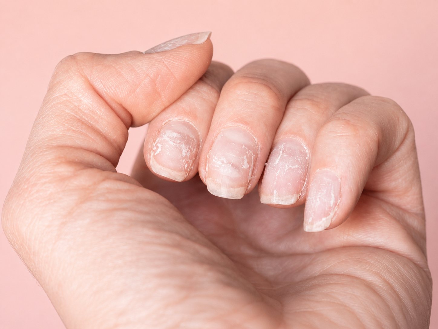 Bare natural nails showing peeling and surface wear before a repair appointment